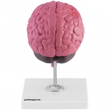 Model anatomiczny 3D mózgu ludzkiego z 3 patologiami skala 1:1