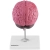 Model anatomiczny 3D mózgu ludzkiego z 3 patologiami skala 1:1